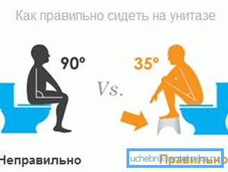 На слици - положај особе на ВЦ-у током дефекације На слици - положај особе на ВЦ-у током дефекације